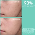 40 ML Apivita JUST BEE CLEAR Crema Idratante Opacizzante Anti-Imperfezioni 5 di 8 Crema Idratante Opacizzante Anti-Imperfezioni