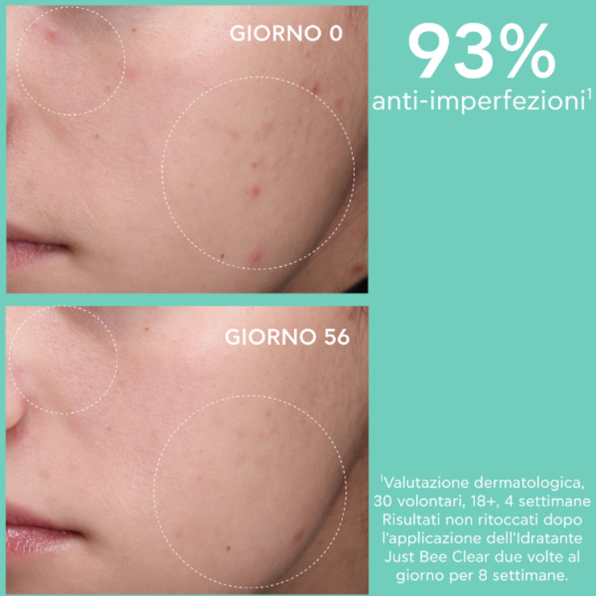 Crema Idratante Opacizzante Anti-Imperfezioni