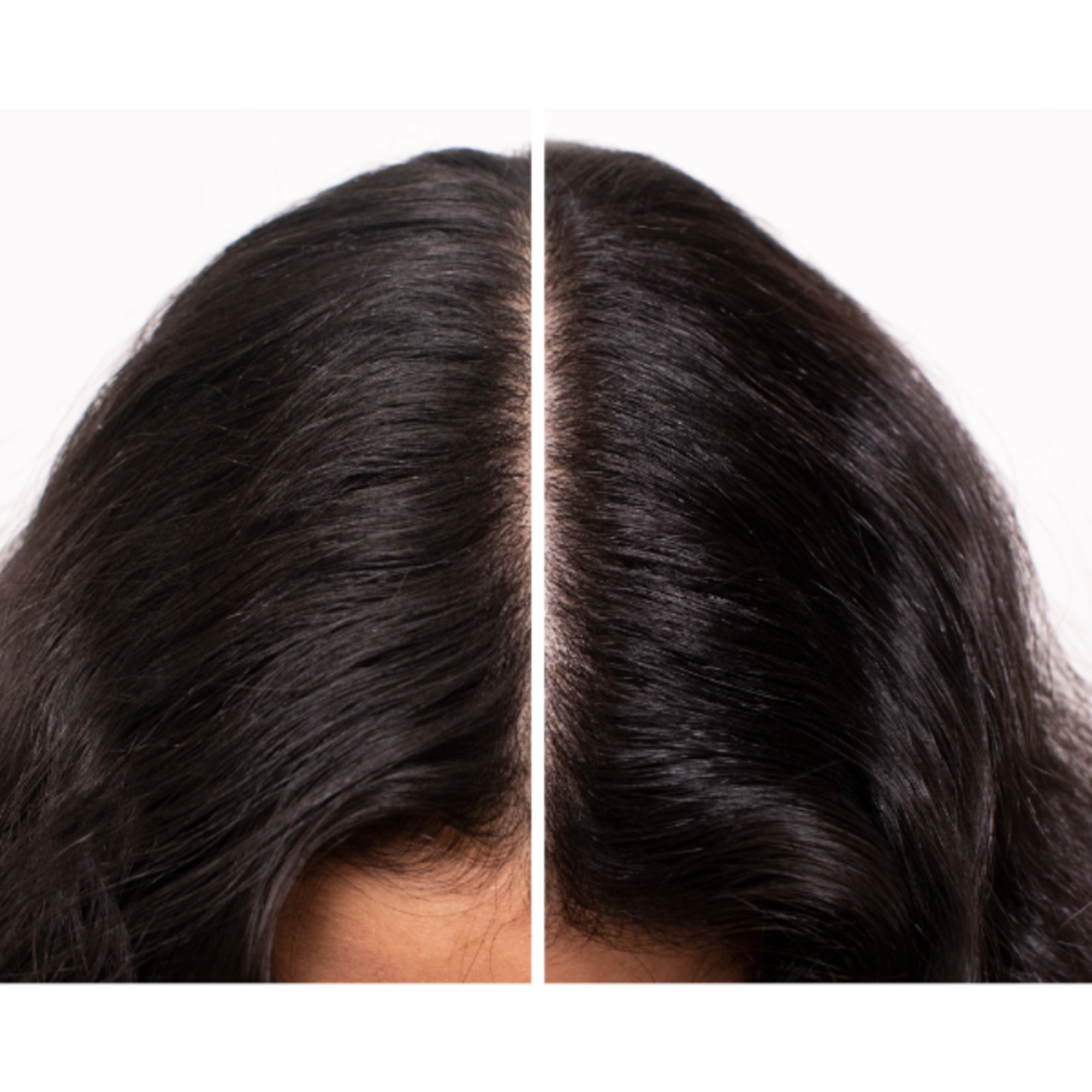 Olio Nutriente Lenitivo Concnetrato per Cuoio Capelluto