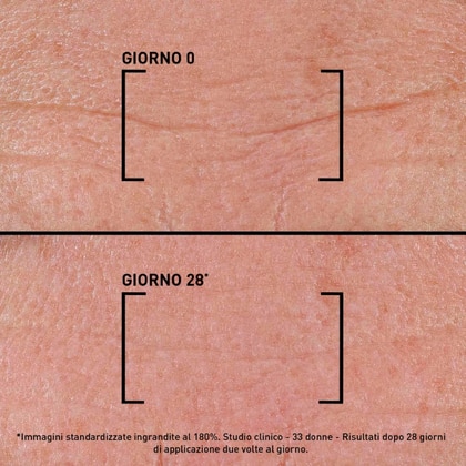 Siero Concentrato per Rughe di Viso e Collo