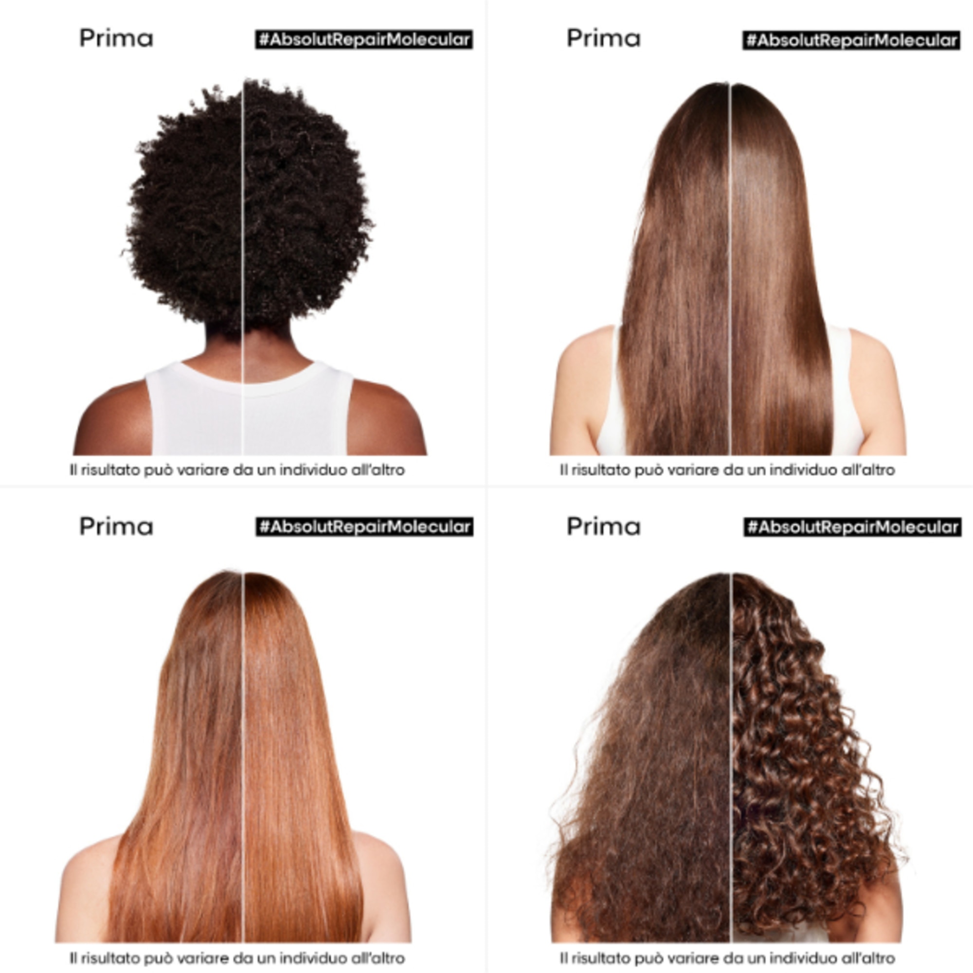 LP SE ARM SHP 300ML R VB98