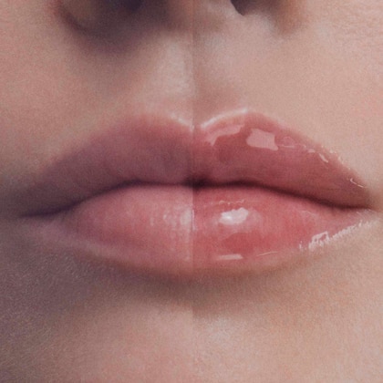 15 ML Filorga HYALU-FILLER LIPS Balsamo per Labbra 1 di 5